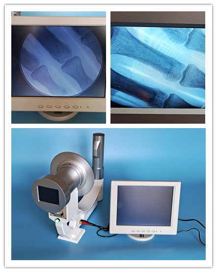 高档便携式X光机骨科透视仪X光家用高清工业检测X光机探伤X射线机
